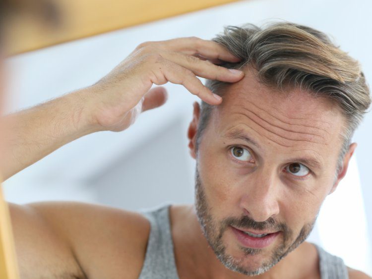 Whitening of hair\ Greying of hair\ Premature greying of hair. Why?