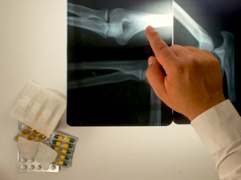 Yes! Hip Bone can determine your Age.